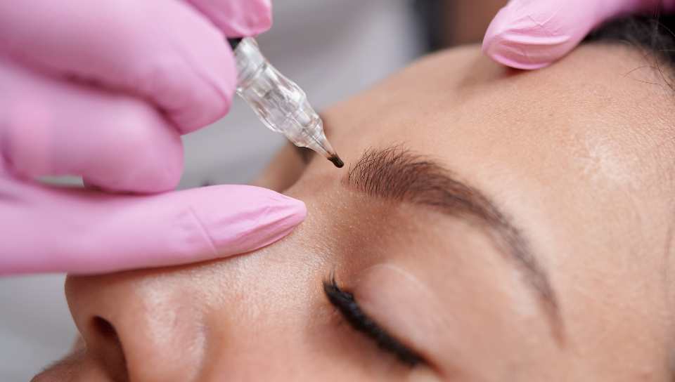 sandra estetica microblanding